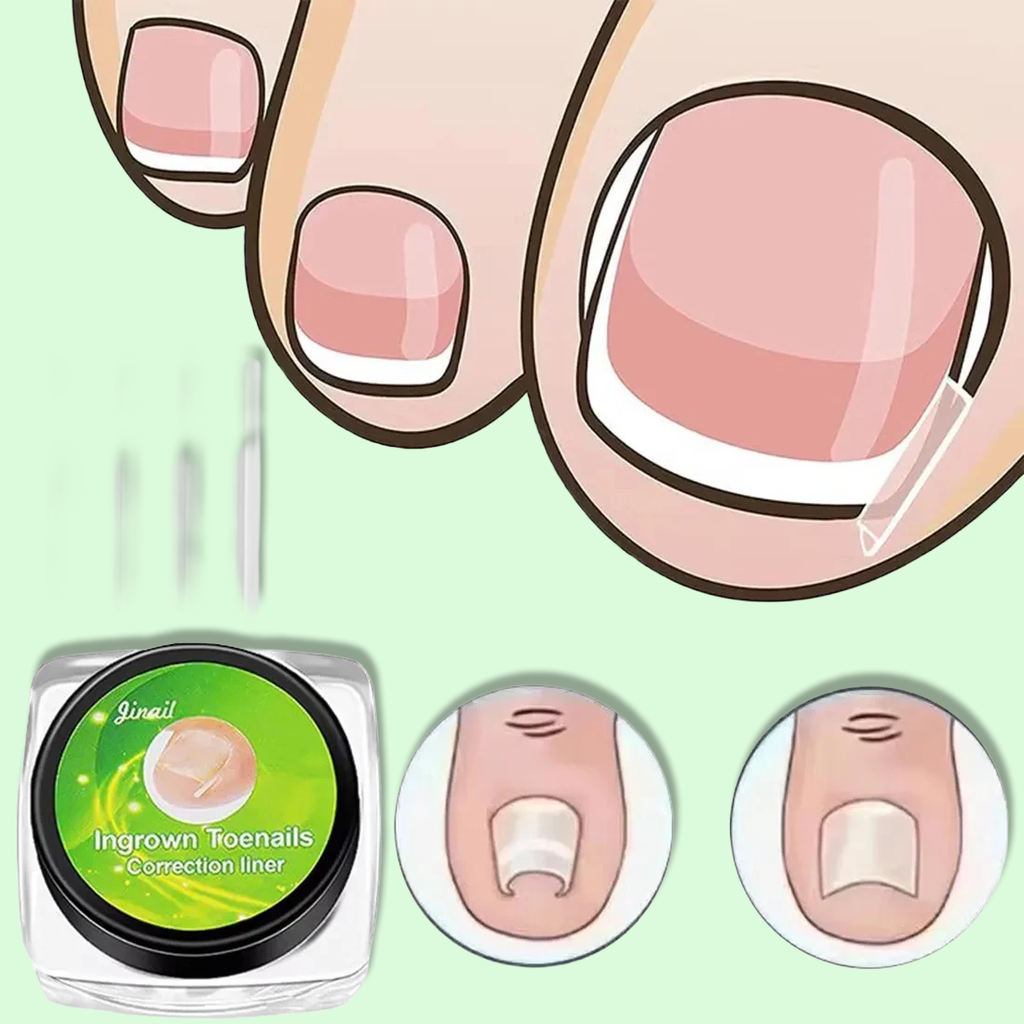 Zavaria ComfortStep Nail Relief Kit