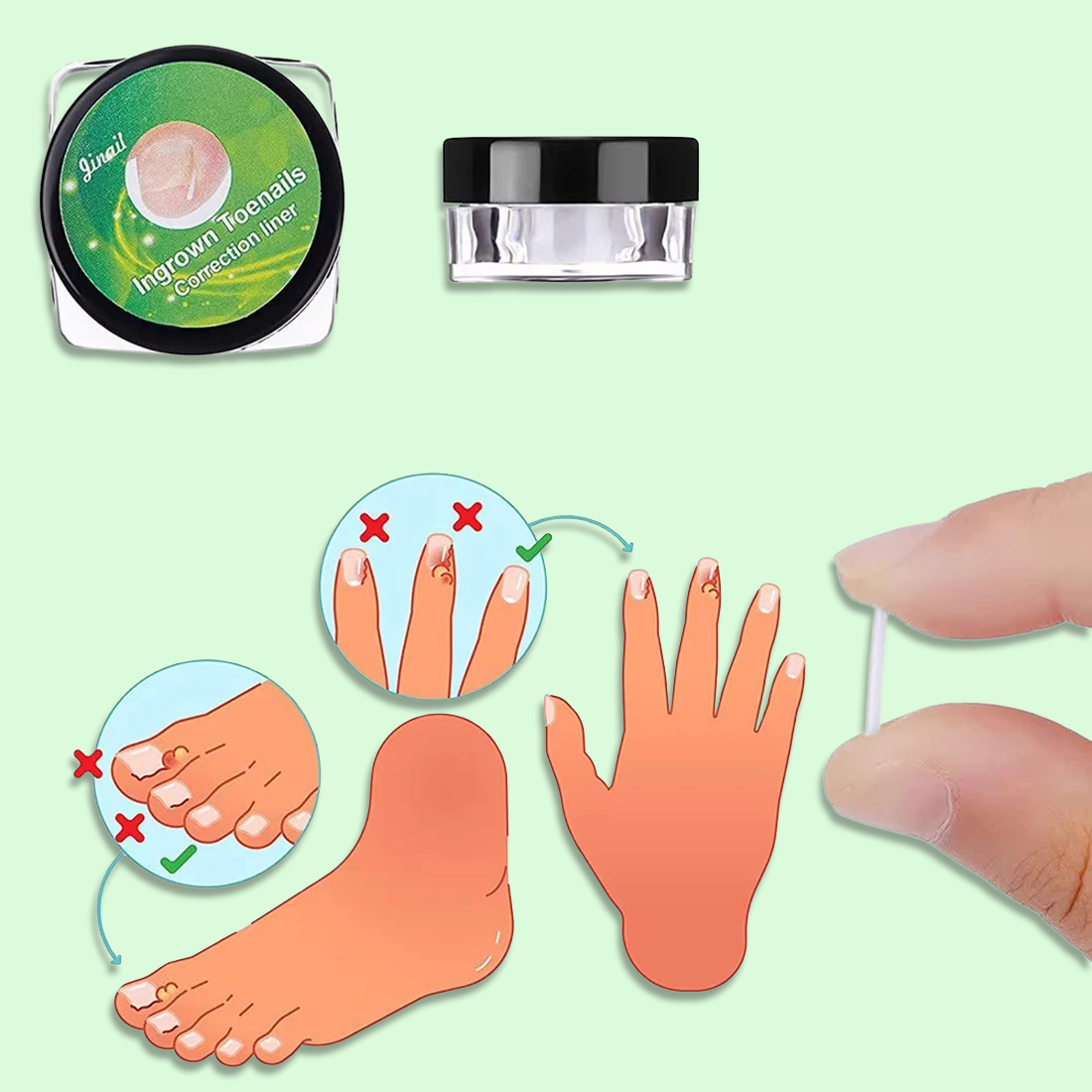 Zavaria ComfortStep Nail Relief Kit