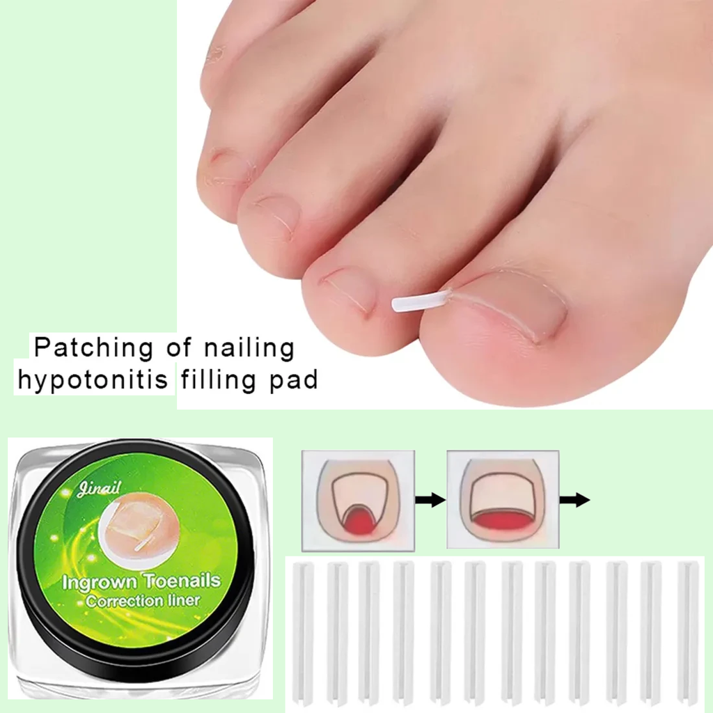 Zavaria ComfortStep Nail Relief Kit