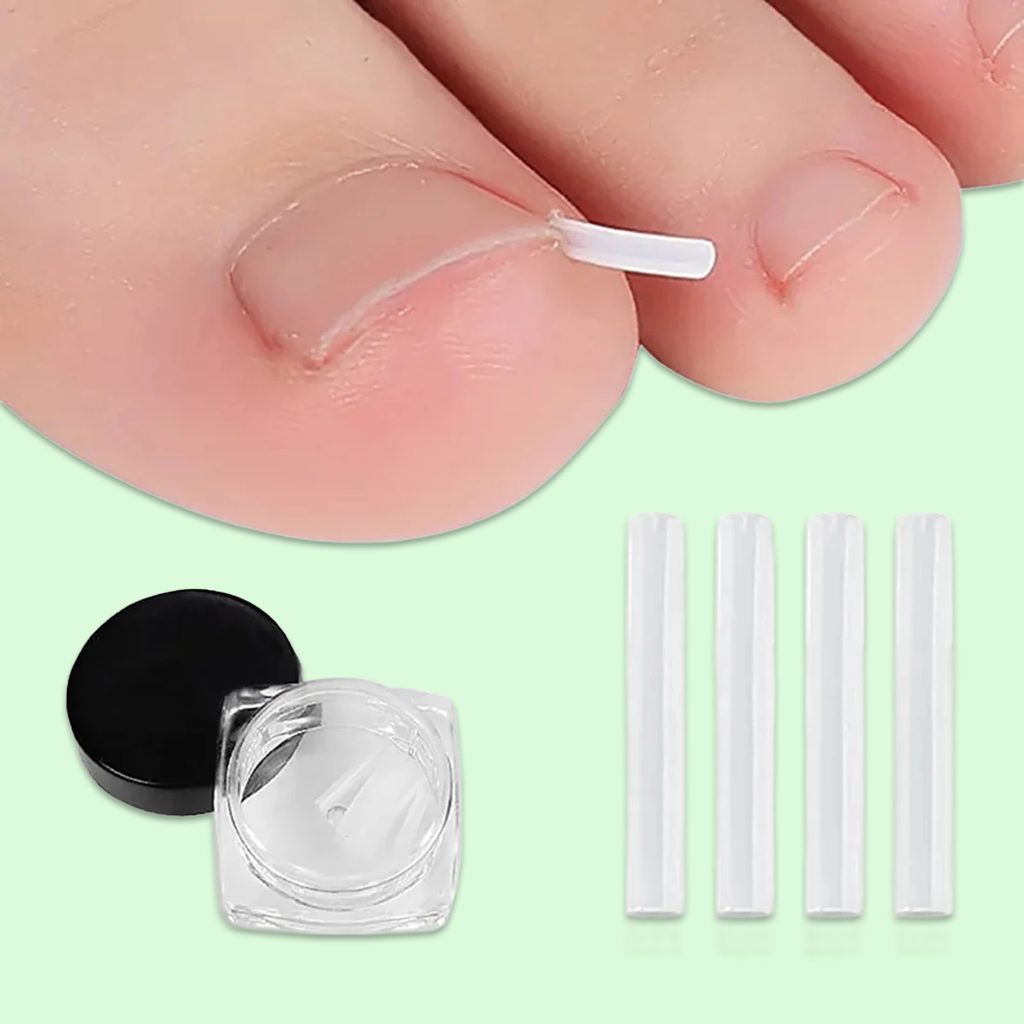 Zavaria ComfortStep Nail Relief Kit