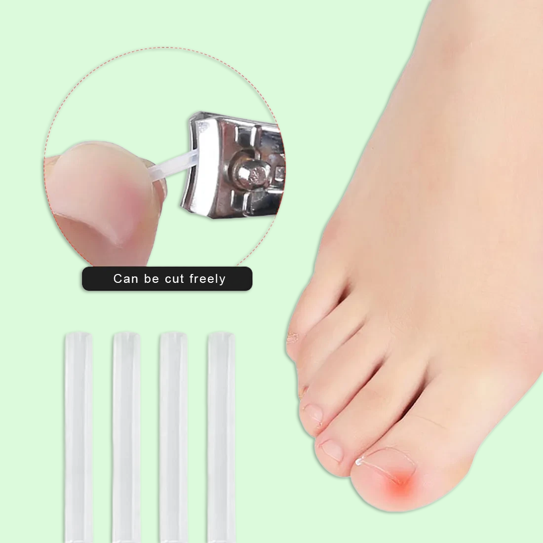 Zavaria ComfortStep Nail Relief Kit